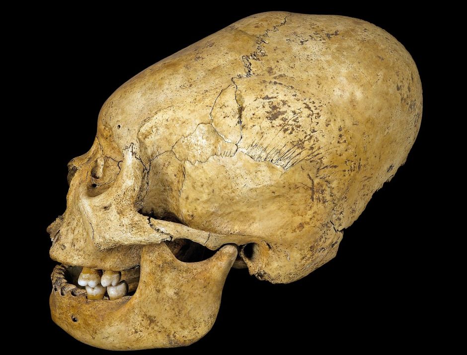 Los impresionantes cráneos humanos deformados intencionalmente en China hace 12.000 años
