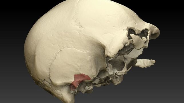 Así ‘curamos’ un caso de sordera de hace 430.000 años