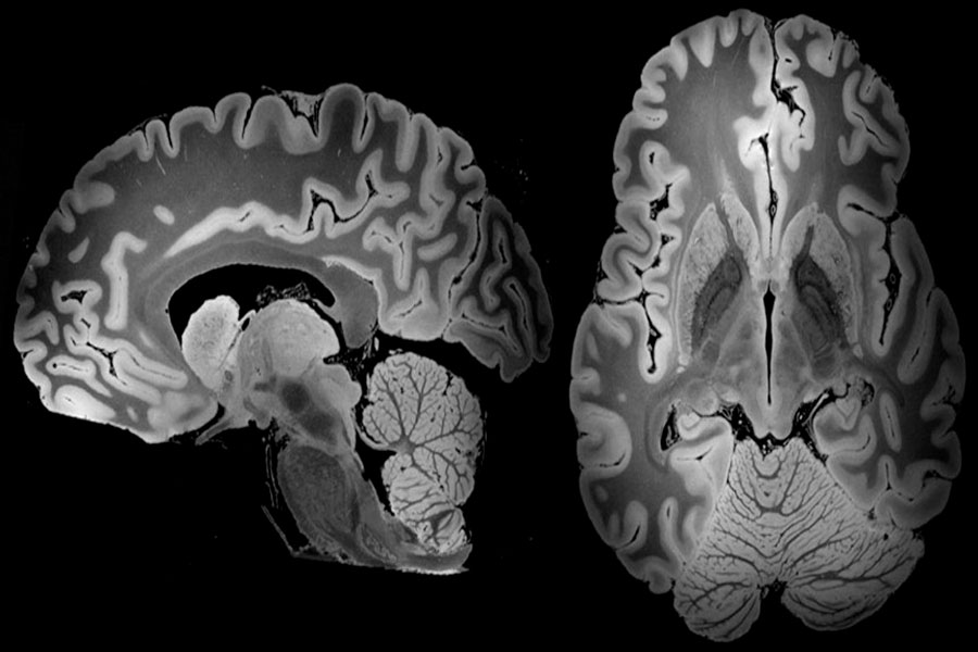 Resonancia magnética nos da la imagen más detallada del cerebro humano