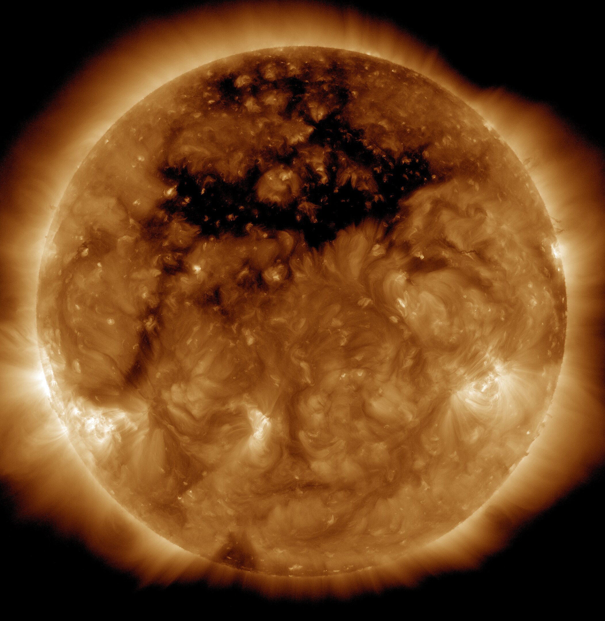 Agujero coronal